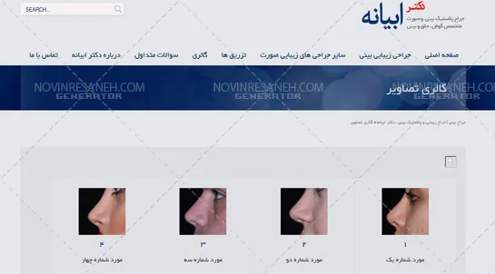 تصویر 4 - پروژه طراحی سایت تخصصی پزشکی و جراحی زیبایی دکتر ابیانه